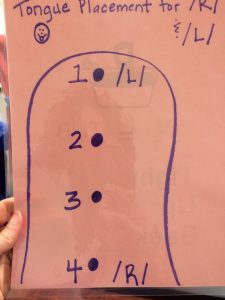 Articulation Therapy Tongue Placement
